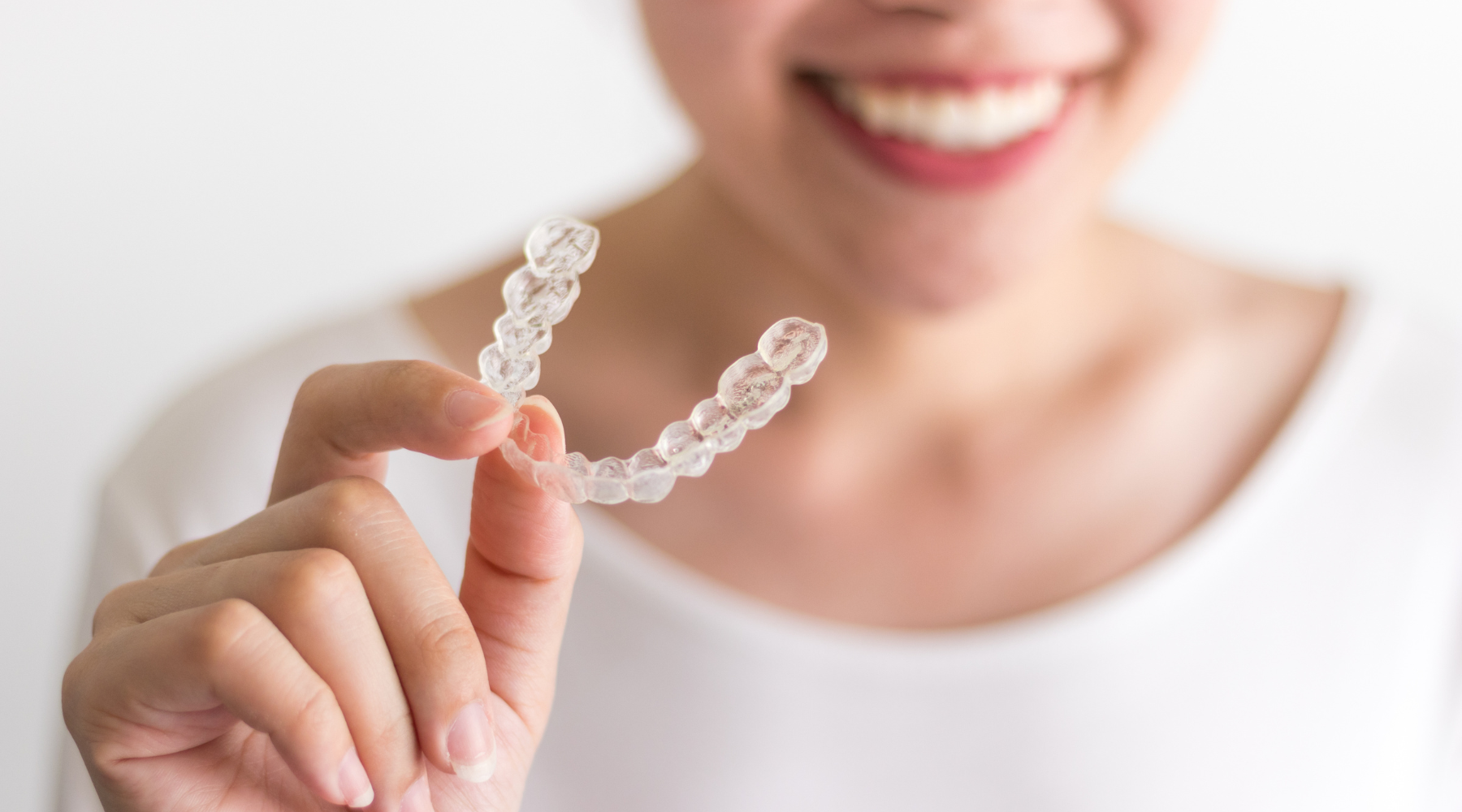 clear aligners