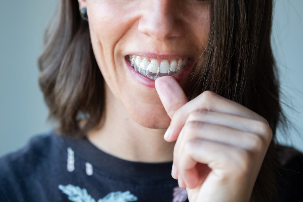 invisalign near me