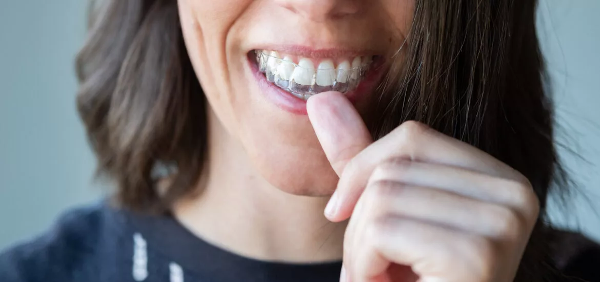 invisalign near me