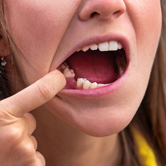 Flemington dental implants